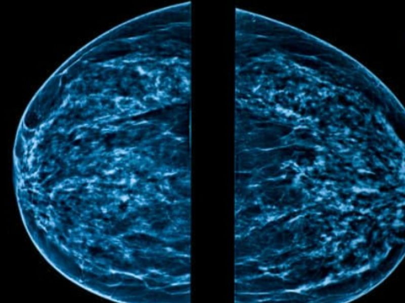 新研究質疑X光造影的益處